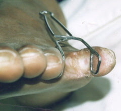 Toe Spreader